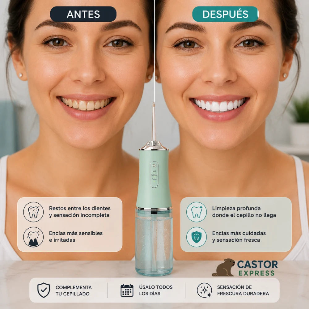 . AquaDent Max- Irrigador bucal - Limpieza profesional desde casa todos los días