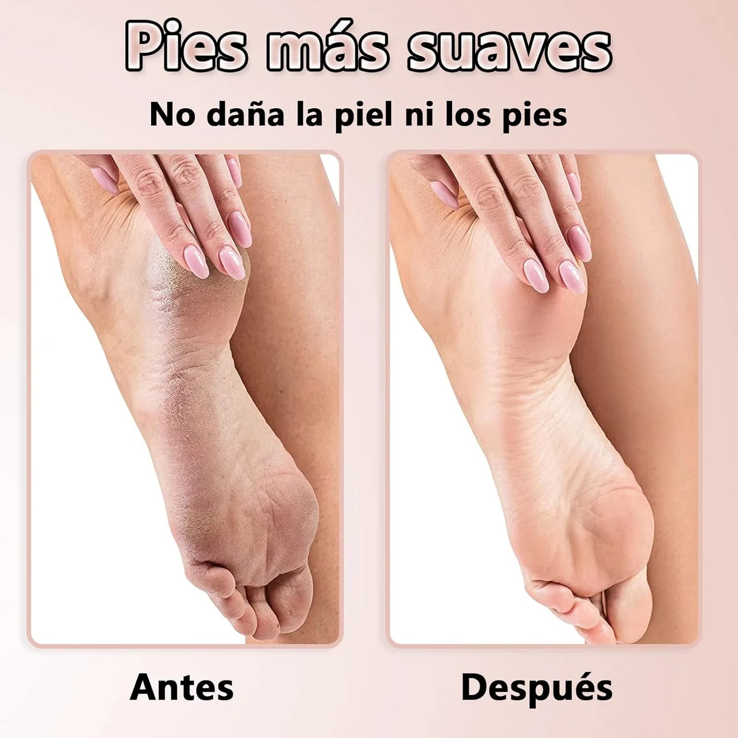 . Electric Pedi - Lima Profesional de Callos - Disfruta pies renovados. ¡Últimas unidades!
